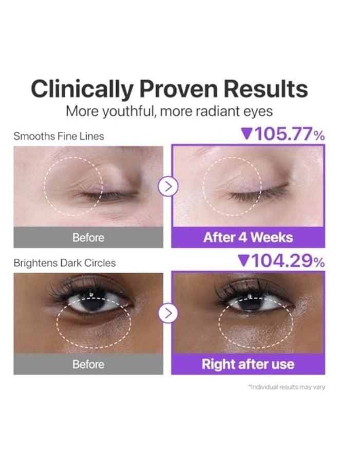 Numbuzin No.9 Eye Cream | NAD+ Retinol Volume Eye Cream | Firming, Wrinkles, Fine Lines, Dark Circles, Puffy | Retinol, Peptides, Niacinamide | Undereye Treatment Serum | 0.33 fl. oz. - Image 3